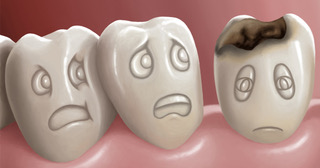 Σωστό ή λάθος; 5 απαντήσεις σε 5 ερωτήσεις για την φροντίδα των δοντιών!